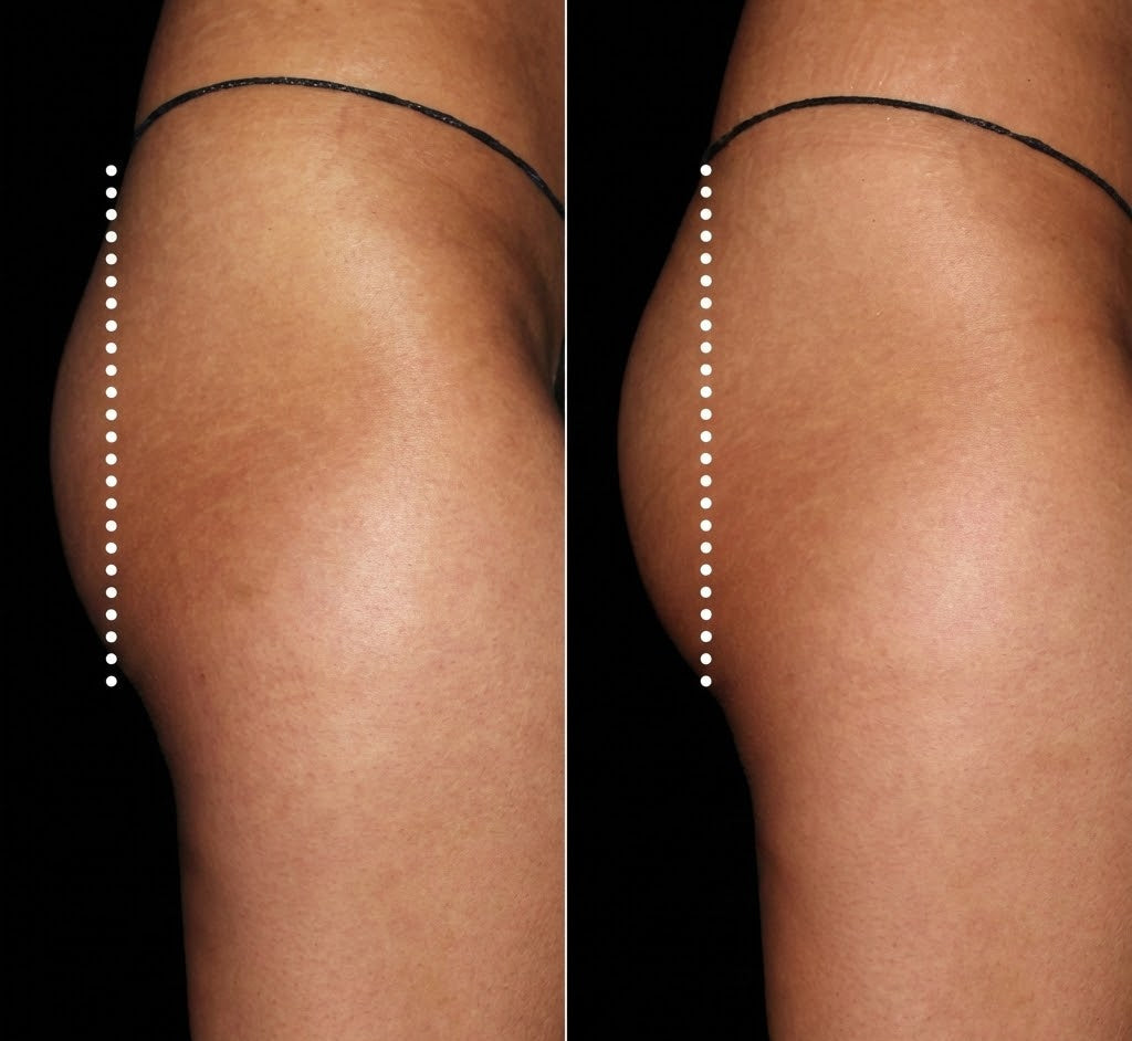 Eleva Push – Short Sculptant et Raffermissant